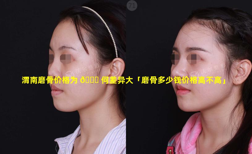 渭南磨骨价格为 🐋 何差异大「磨骨多少钱价格高不高」